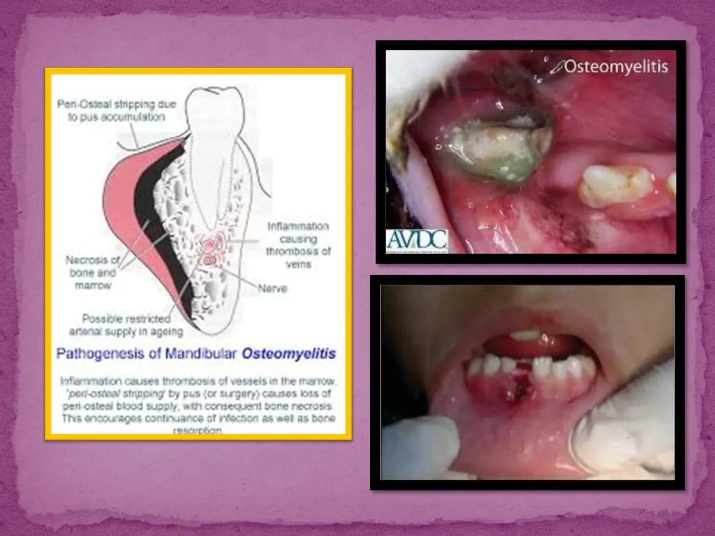 slide5