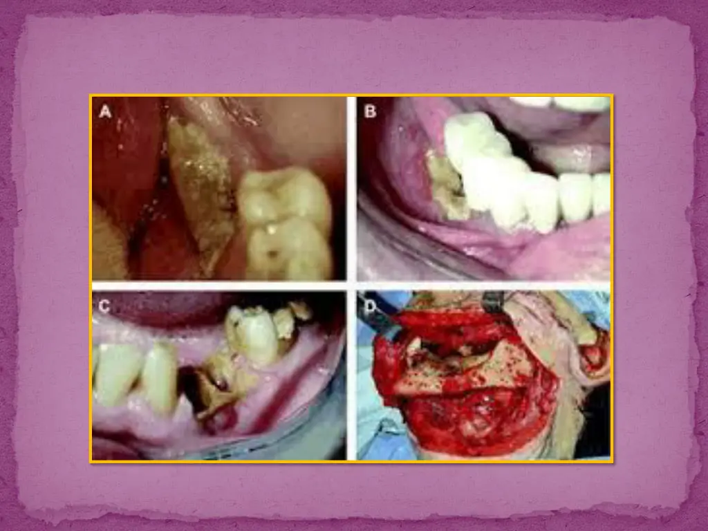 slide6