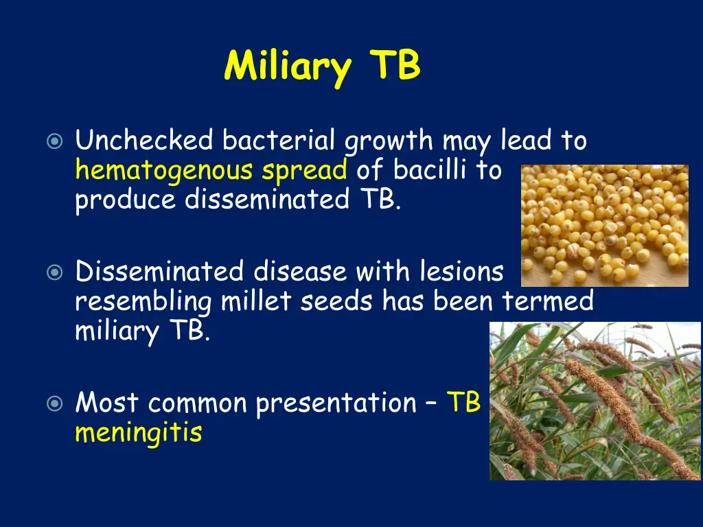 miliary tb