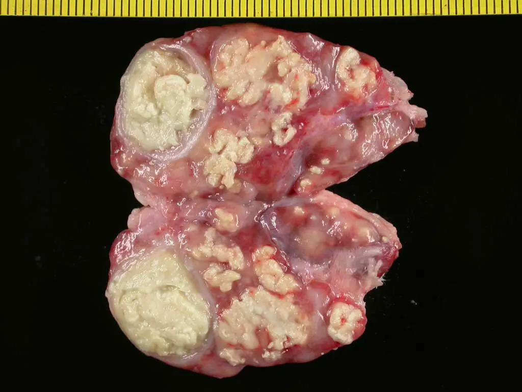 slide15