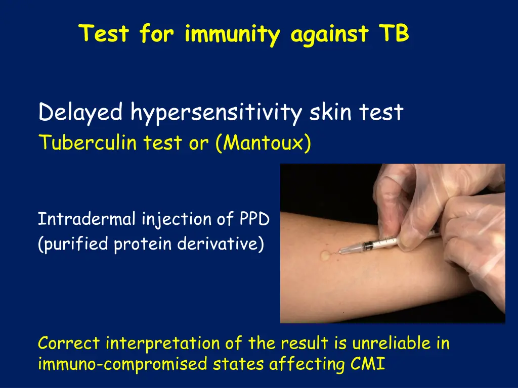 test for immunity against tb