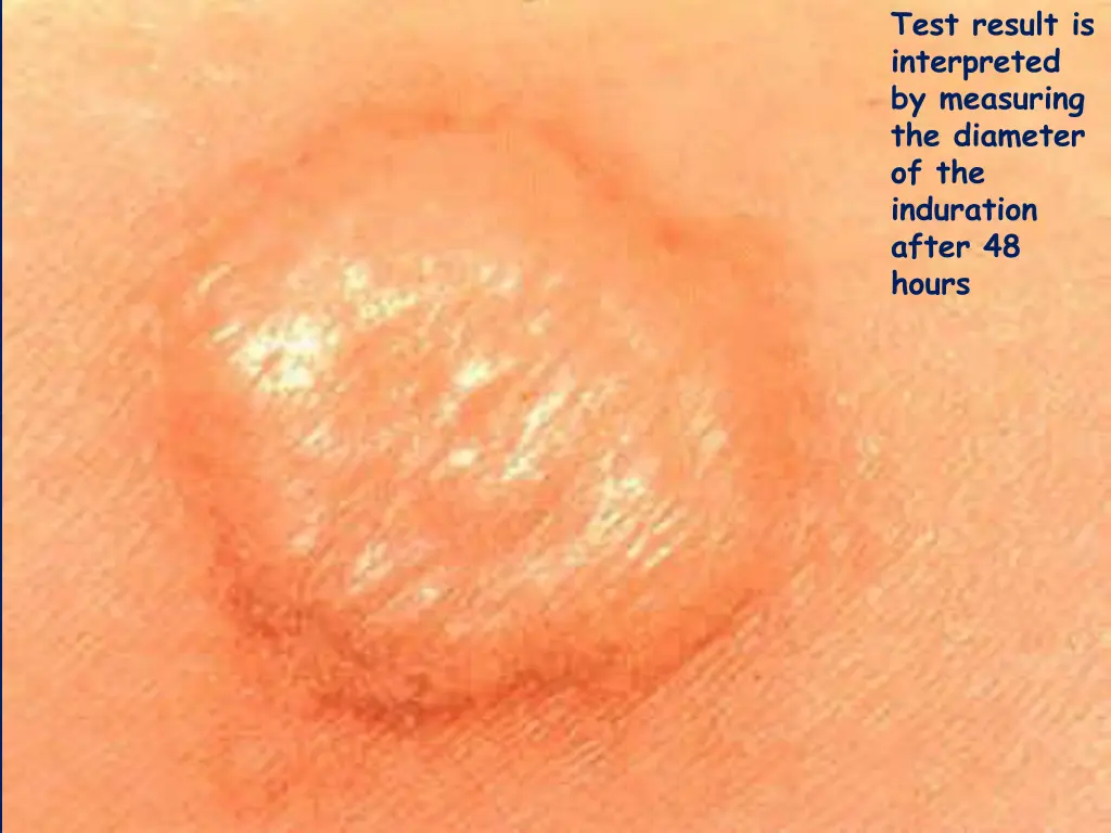 test result is interpreted by measuring