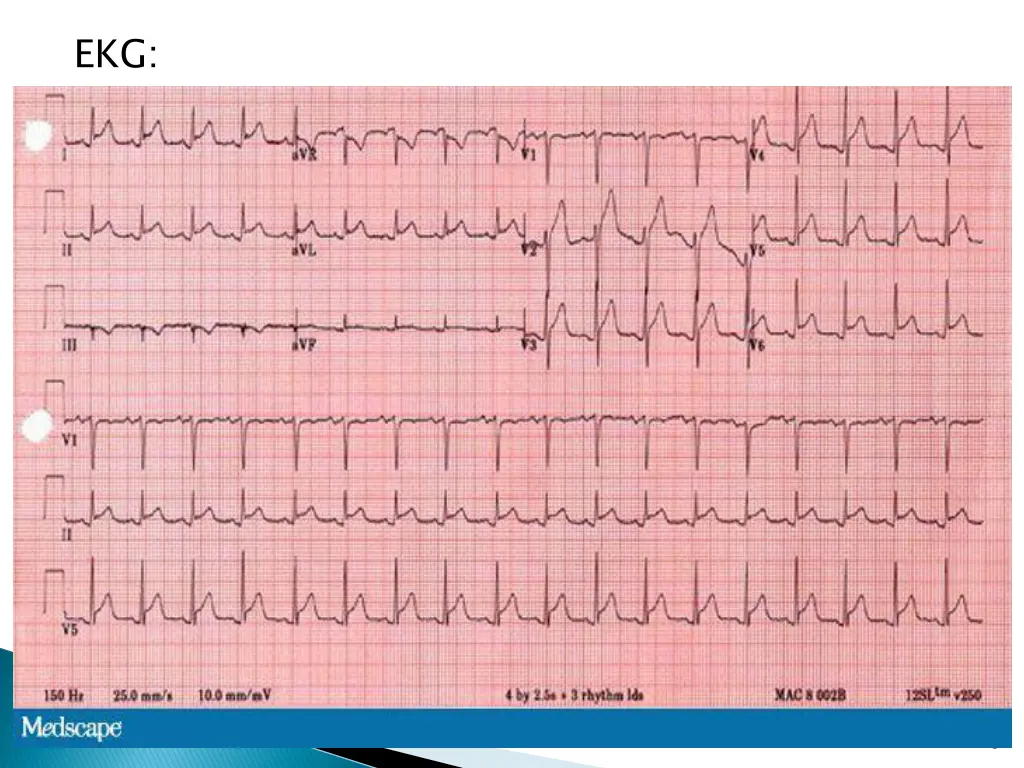 slide8
