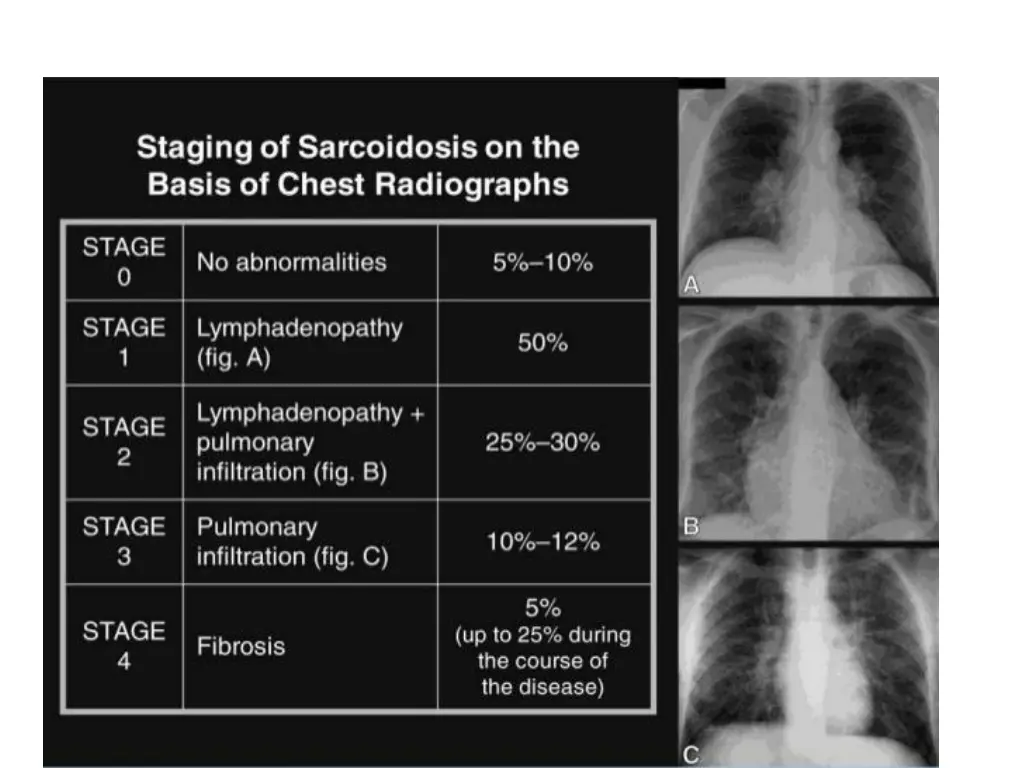 slide9