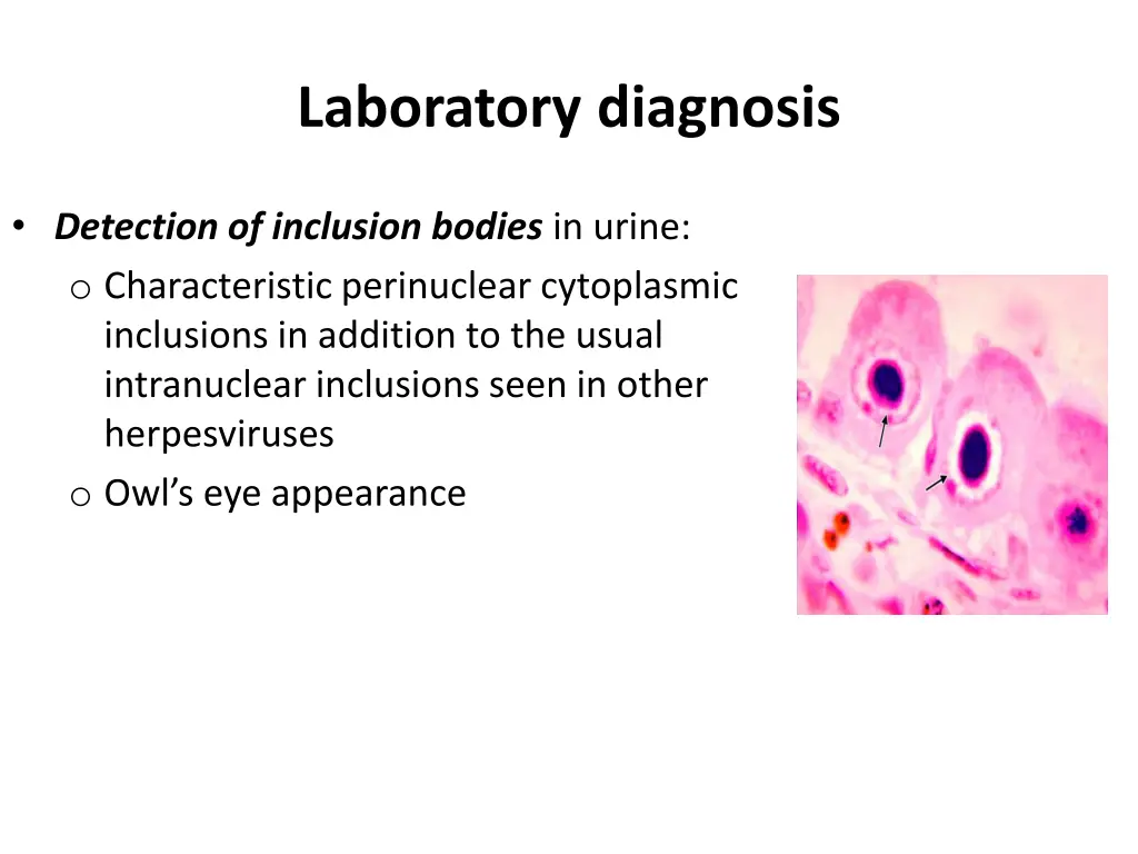 laboratory diagnosis