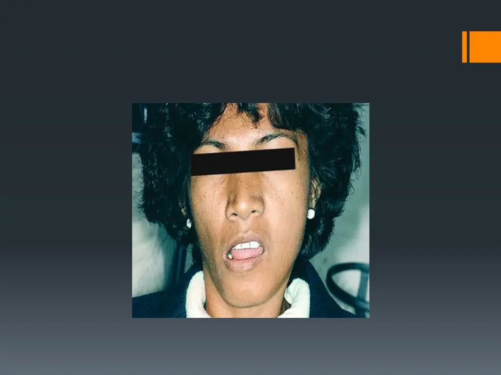 slide13