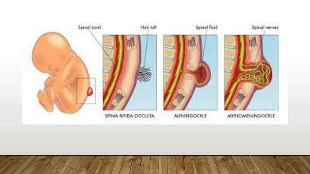 slide4