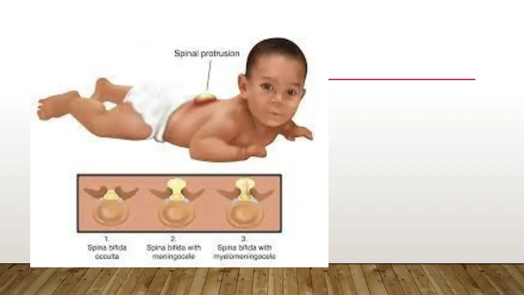 slide5
