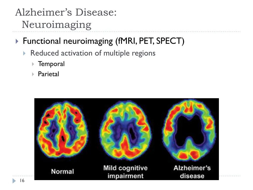 alzheimer s disease neuroimaging 1