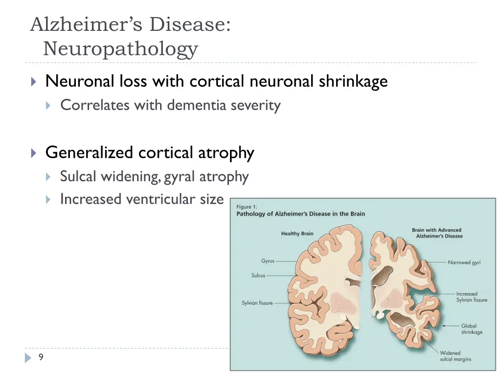 alzheimer s disease neuropathology