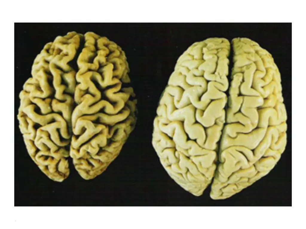 slide10