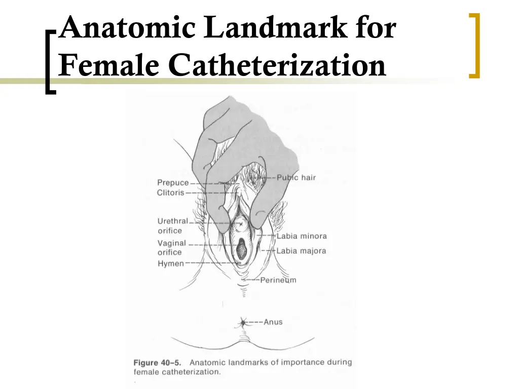 anatomic landmark for female catheterization