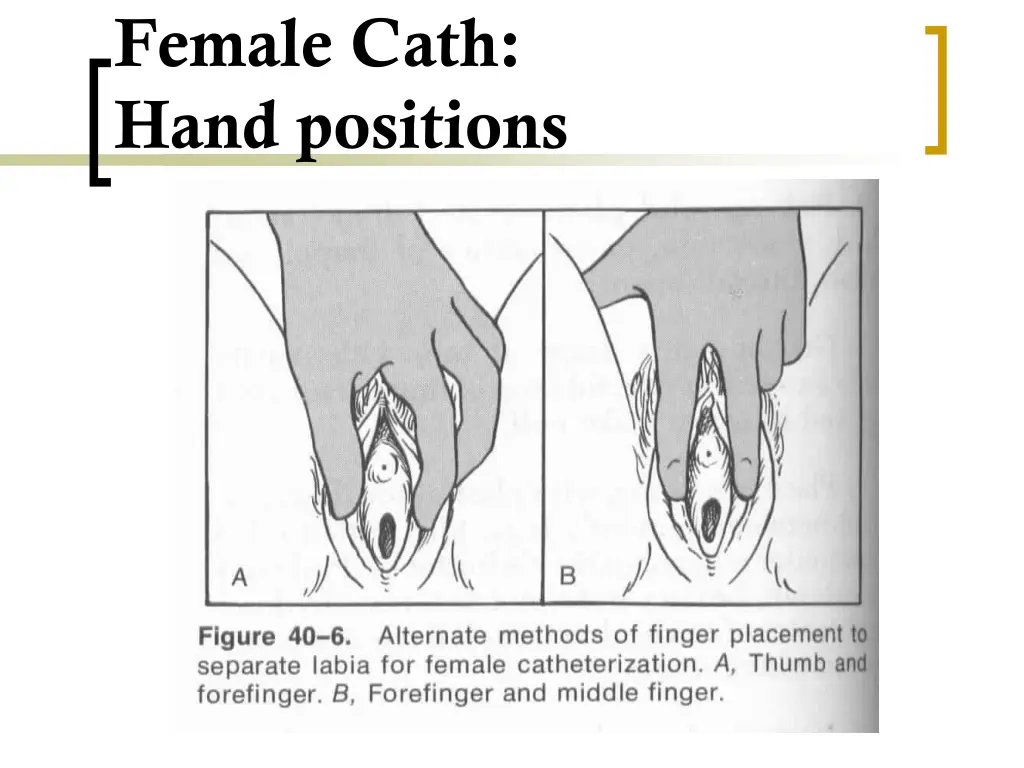 female cath hand positions
