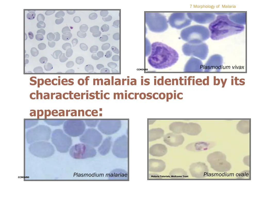 7 morphology of malaria
