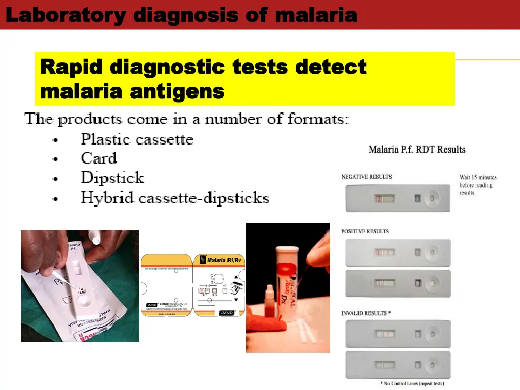 laboratory diagnosis of malaria laboratory