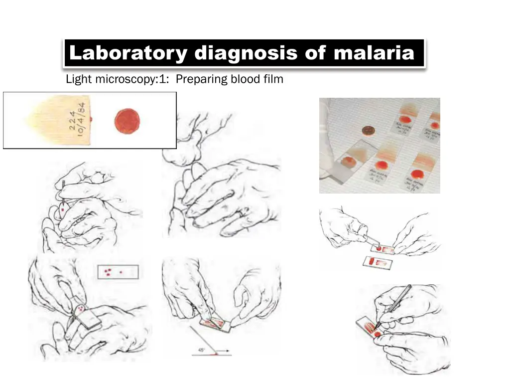 laboratory diagnosis of malaria light microscopy