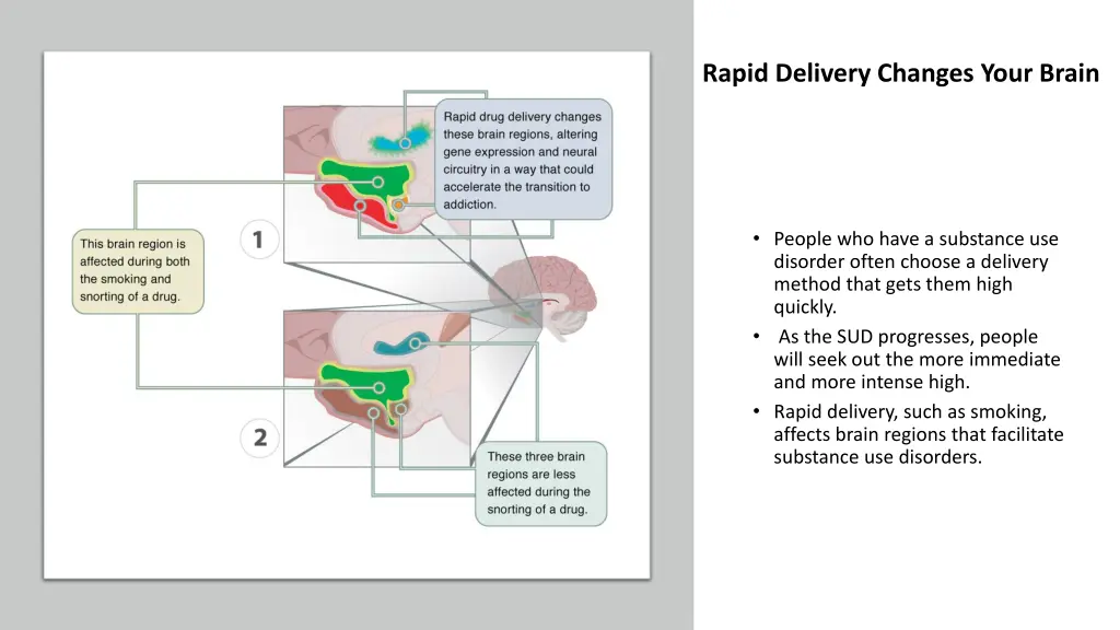 rapid delivery changes your brain