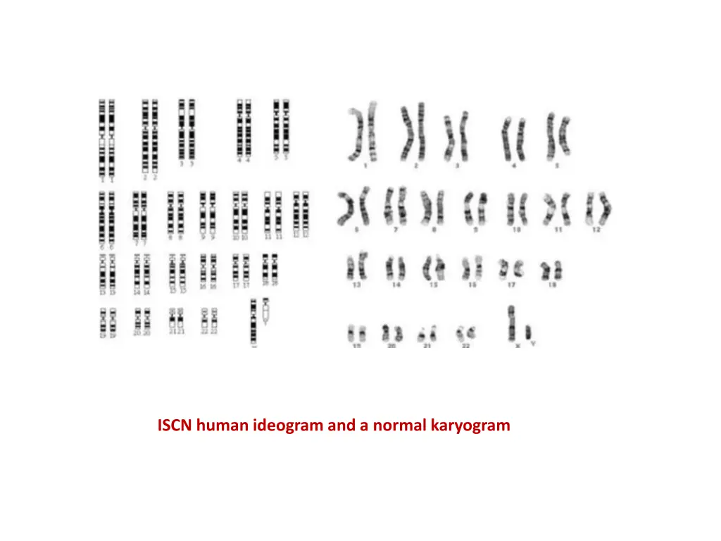 iscn human ideogram and a normal karyogram