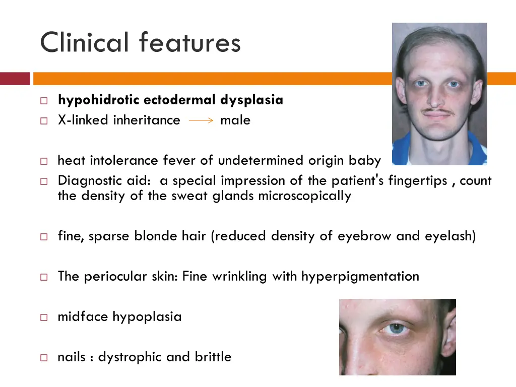 clinical features