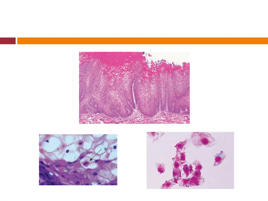 slide11
