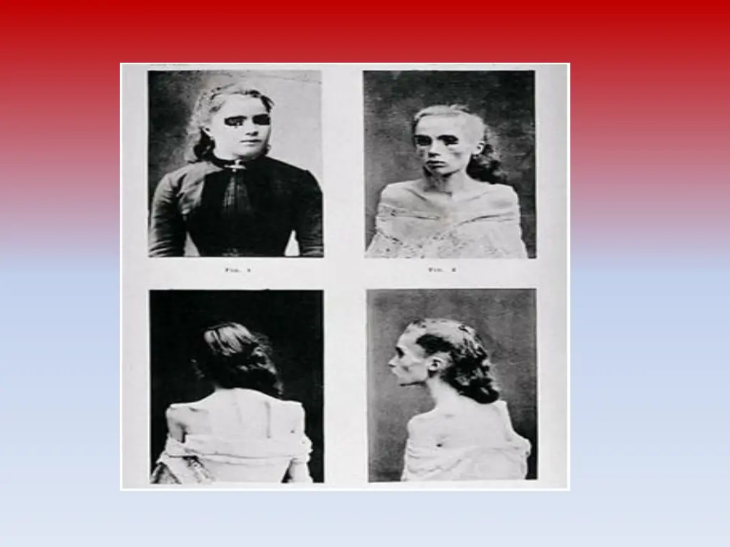 slide3
