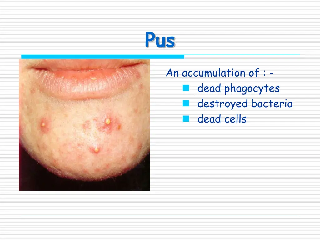 slide9