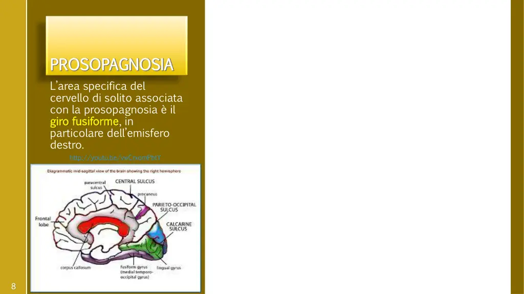 prosopagnosia l area specifica del cervello