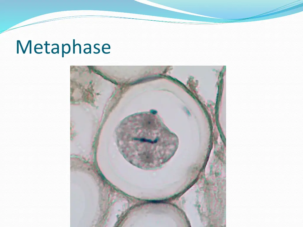 metaphase