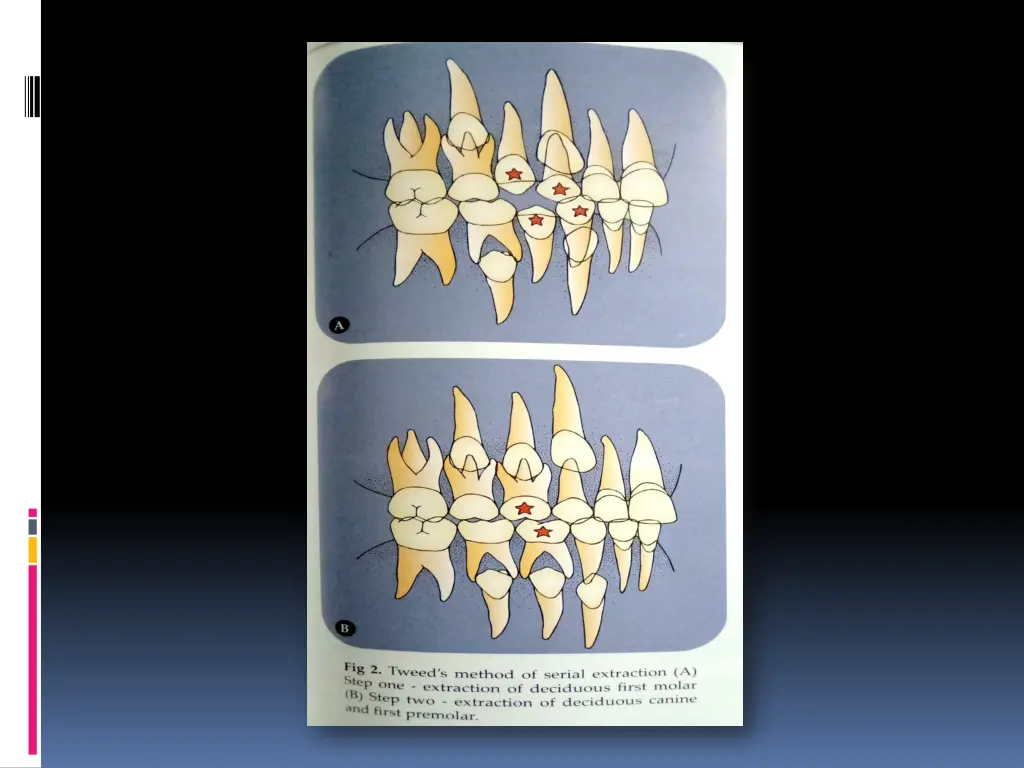 slide22