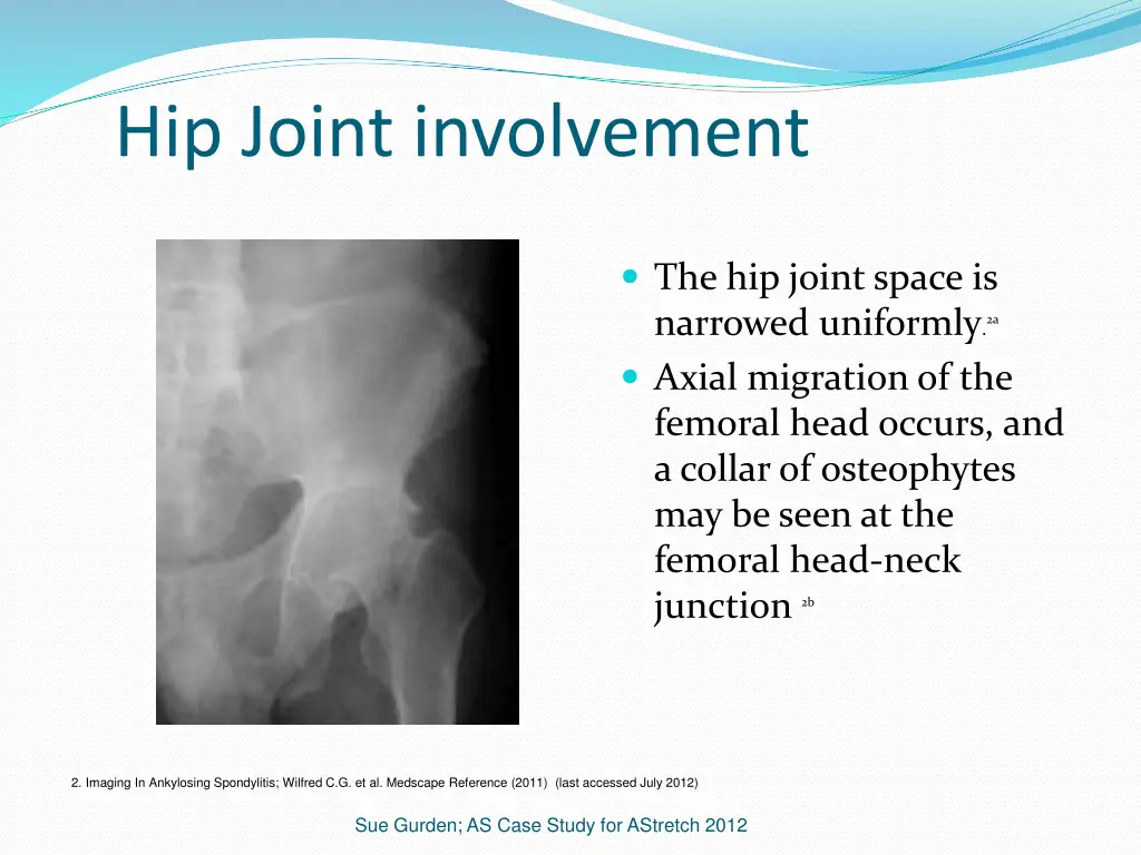 hip joint involvement