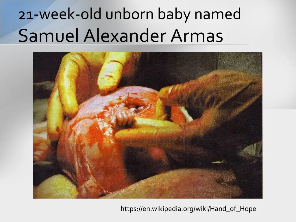 21 week old unborn baby named samuel alexander
