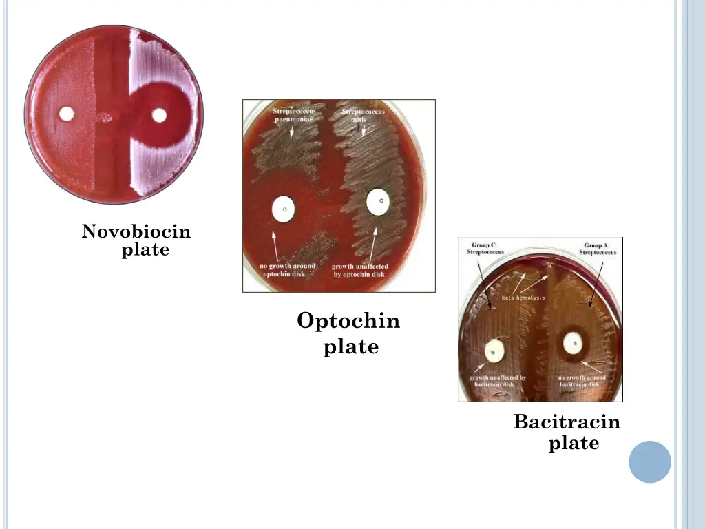 novobiocin plate