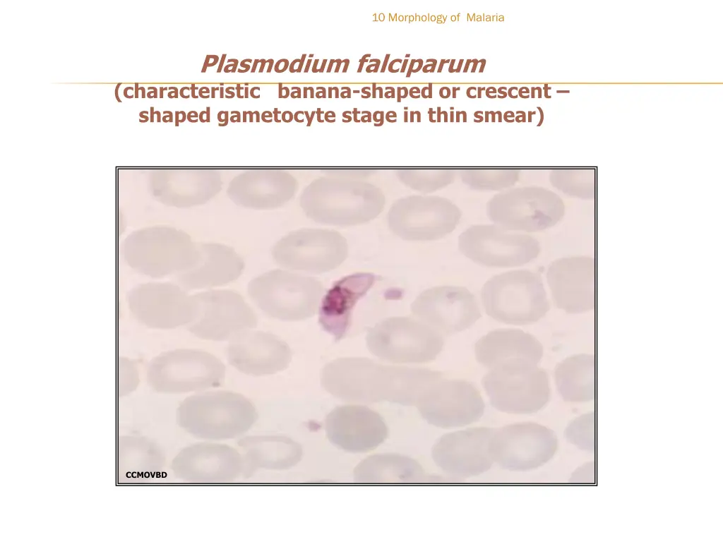 10 morphology of malaria
