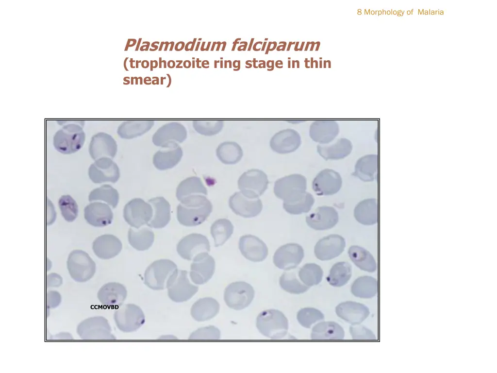 8 morphology of malaria