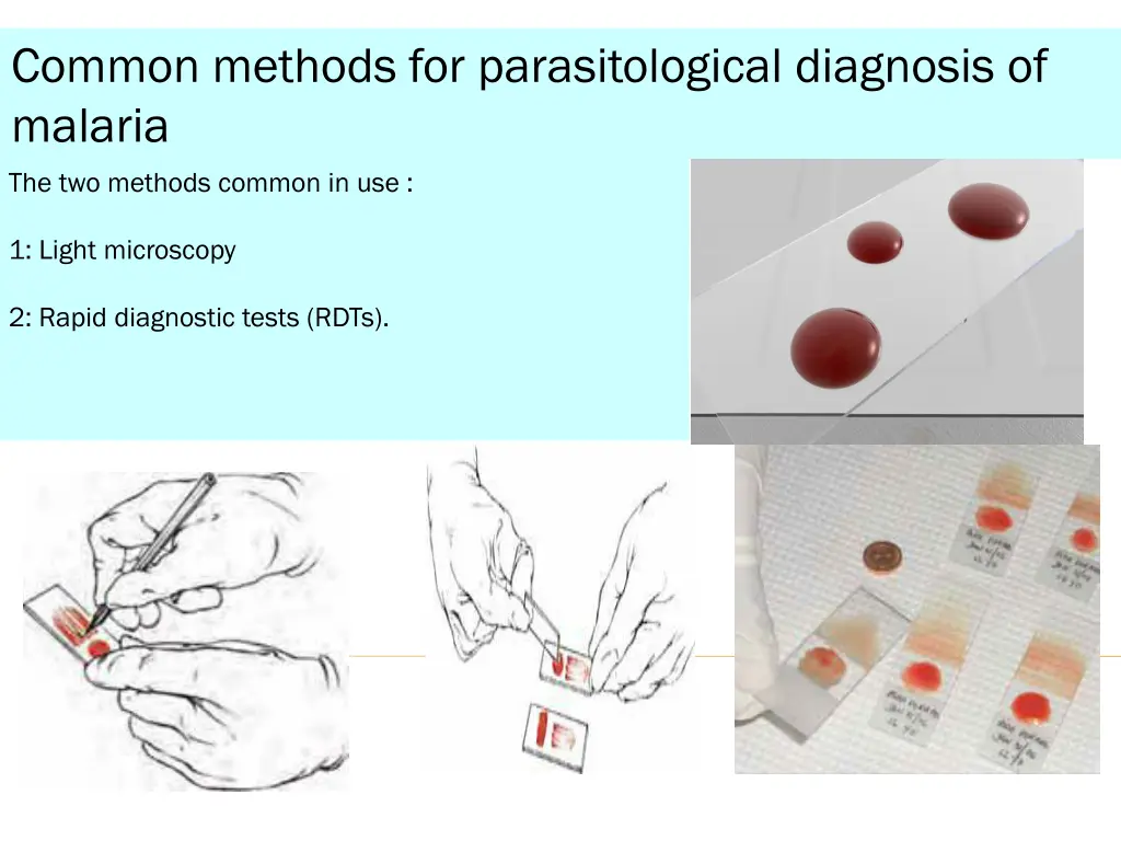common methods for parasitological diagnosis