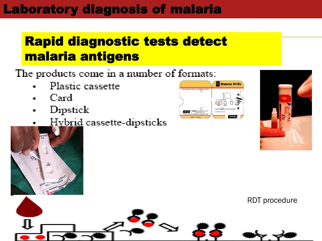 laboratory diagnosis of malaria laboratory