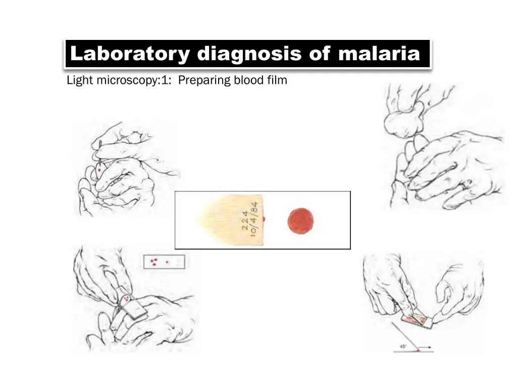 laboratory diagnosis of malaria light microscopy