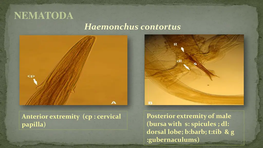 nematoda 15