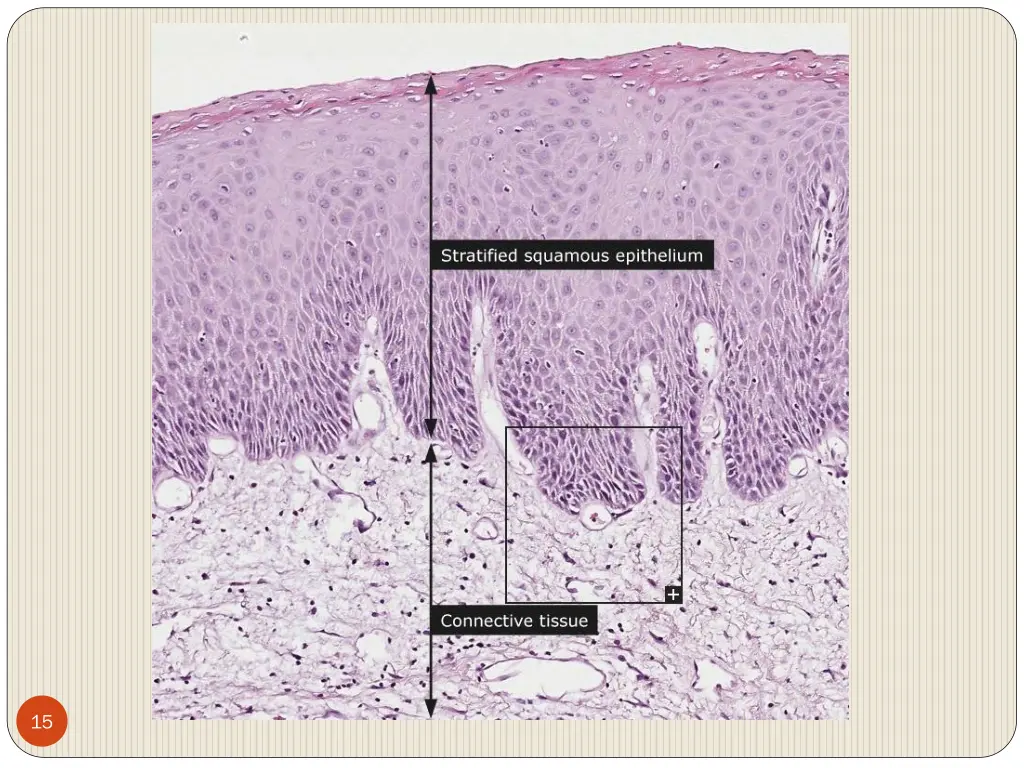 slide15