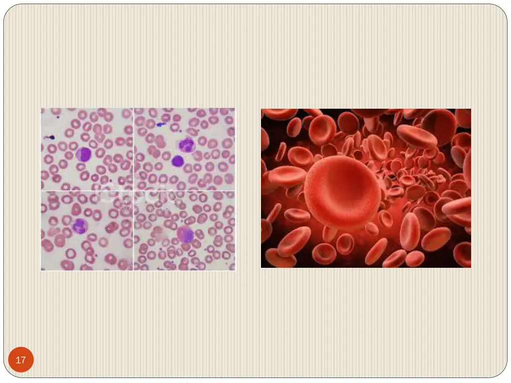 slide17