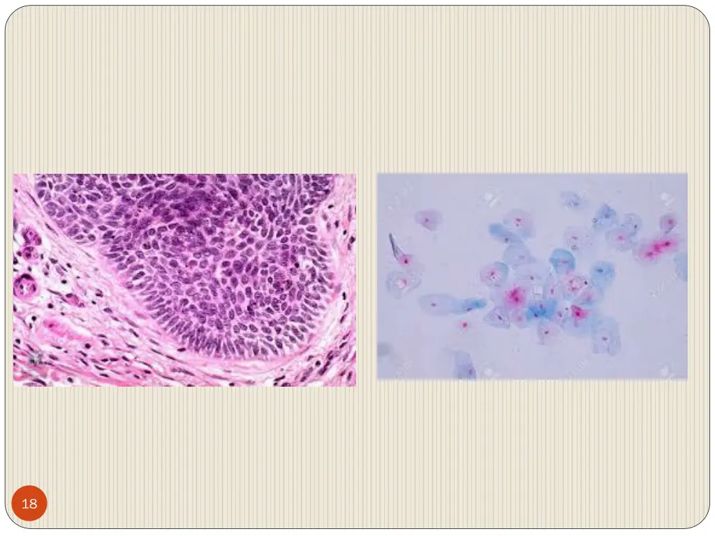 slide18