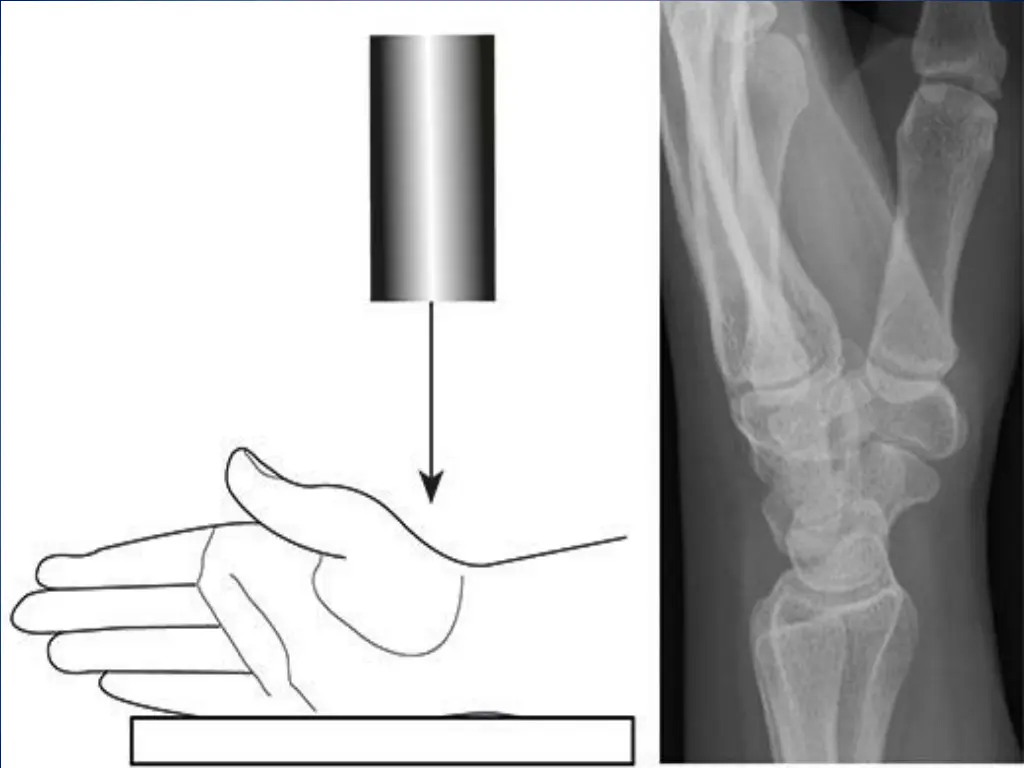 slide6