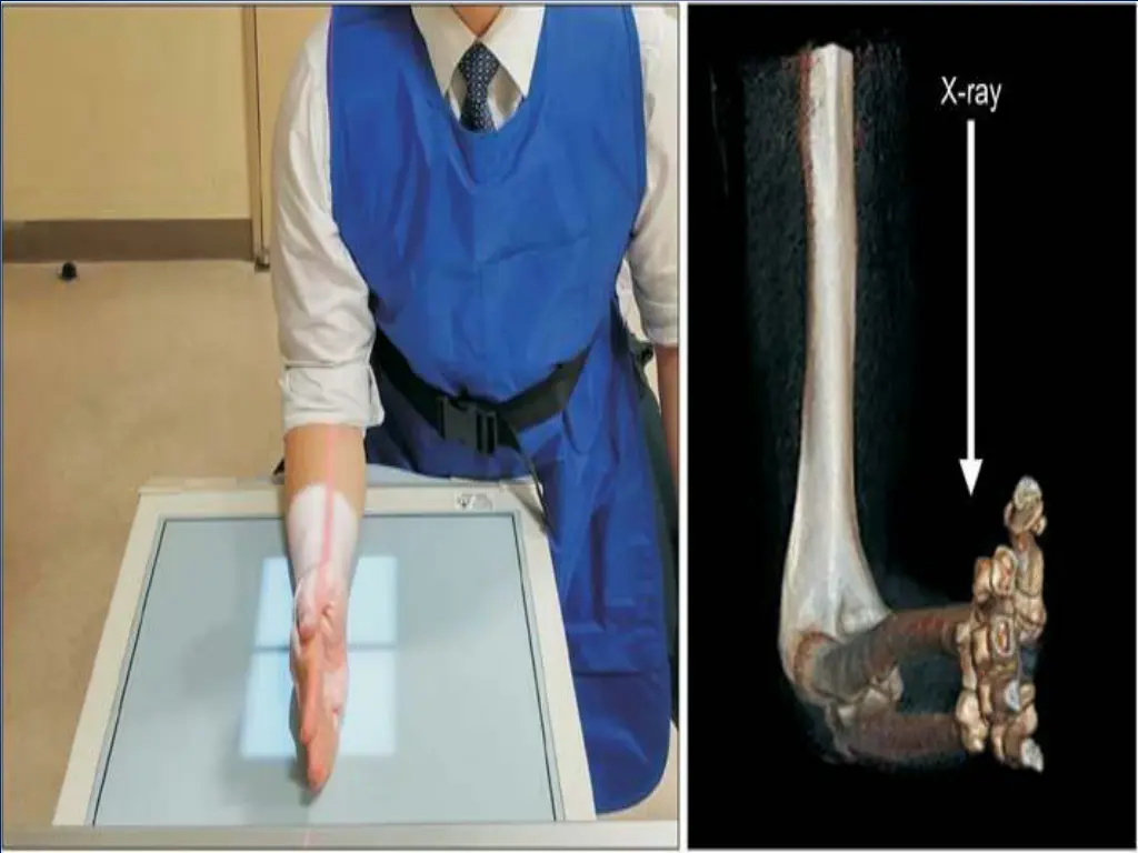 slide7