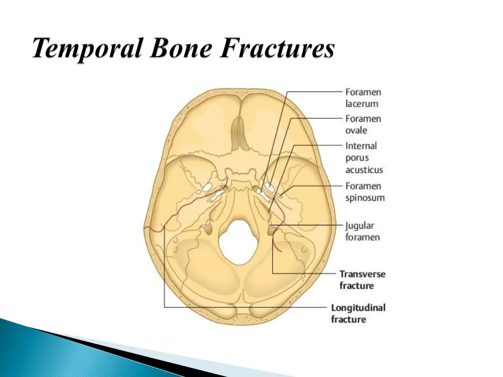 slide7