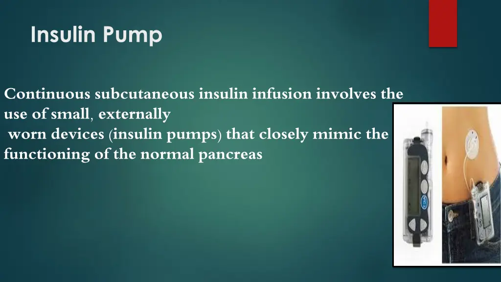 insulin pump