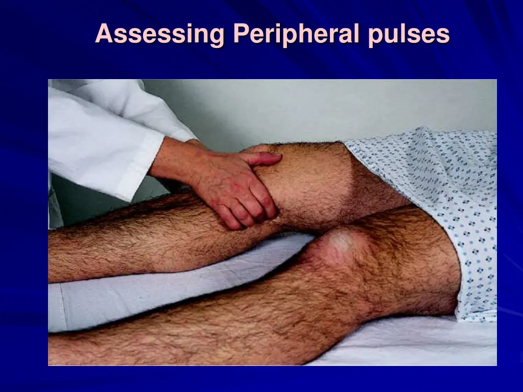 assessing peripheral pulses 2