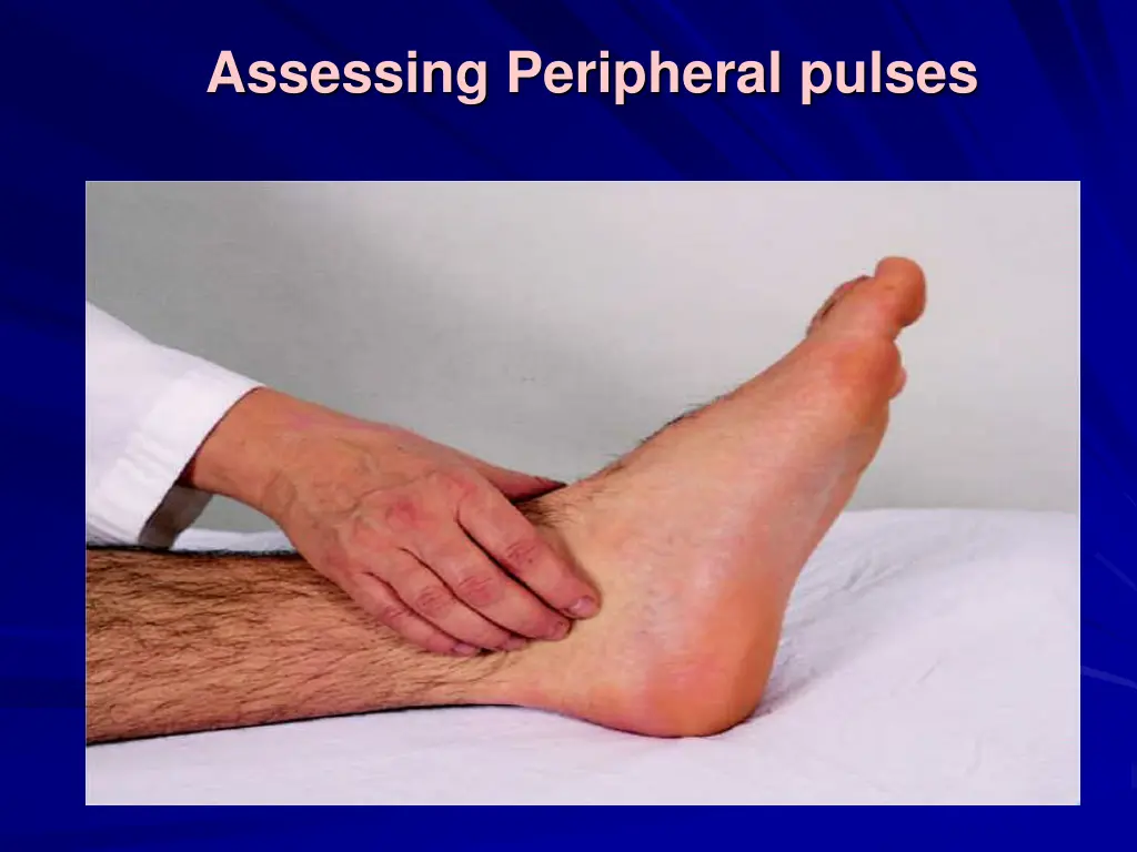 assessing peripheral pulses 3