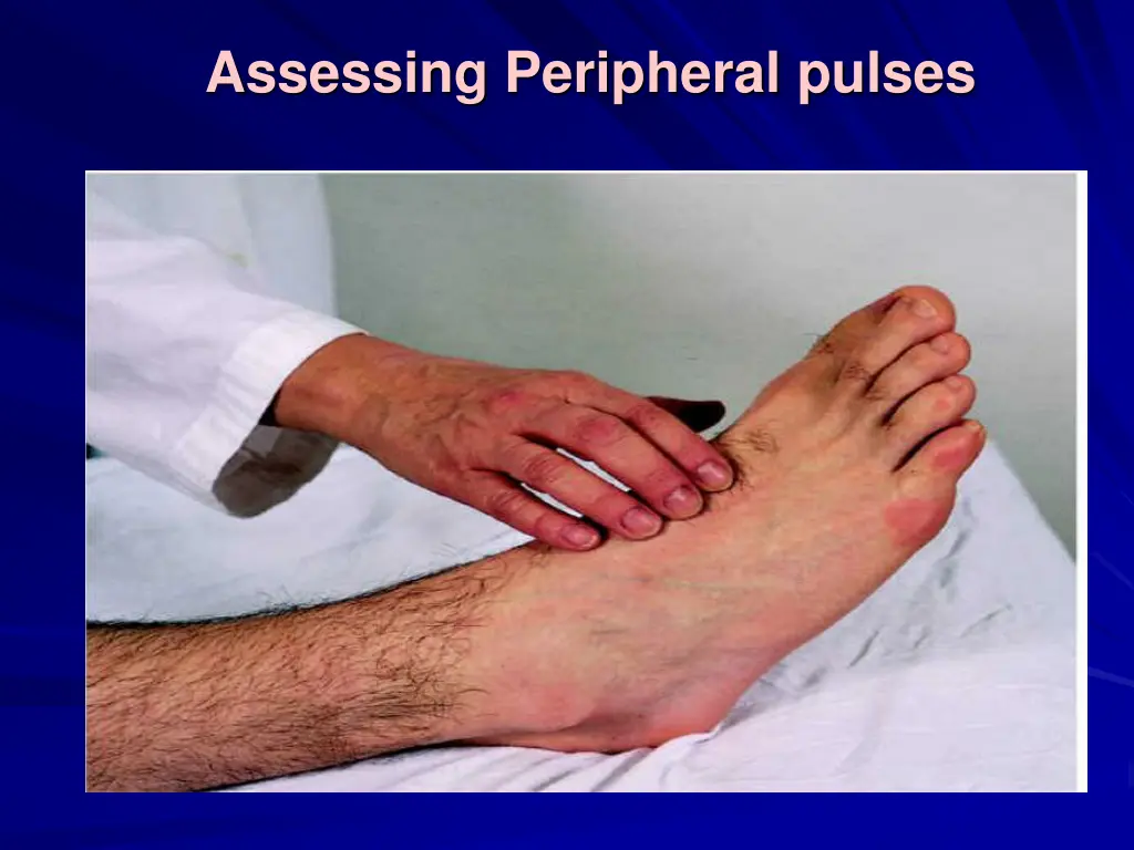 assessing peripheral pulses 4