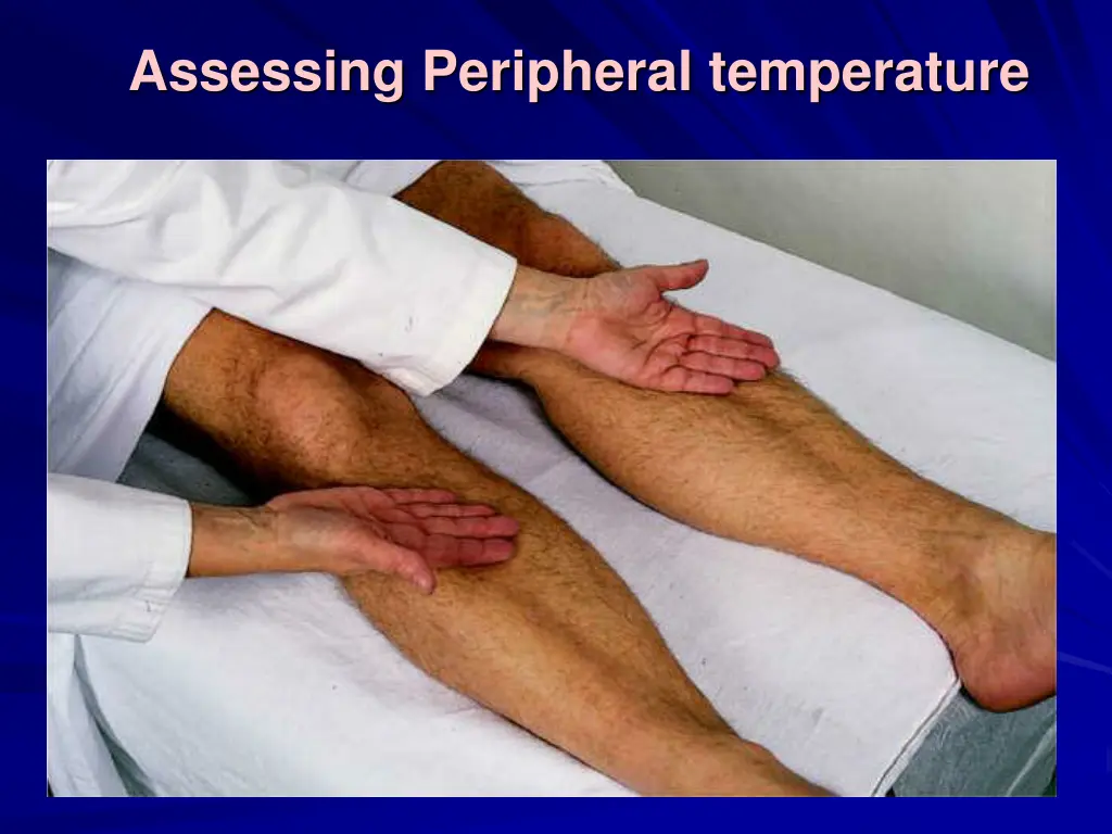 assessing peripheral temperature