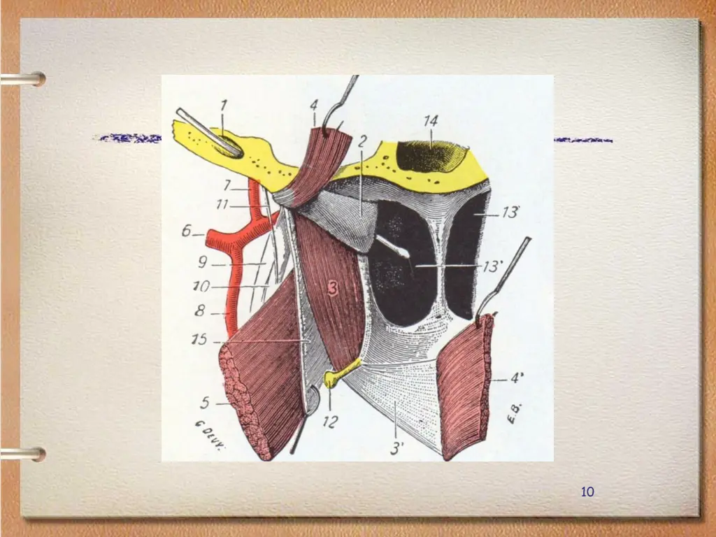 slide10